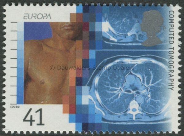 SG1842 41p Tanography 1994 Medical Discoveries